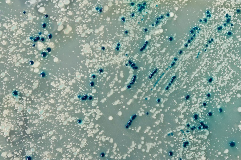 Bacterial colonies growing on a petri dish (Image: Alamy)